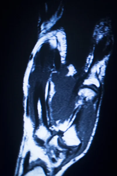 МРТ-магнитно-резонансная томография — стоковое фото