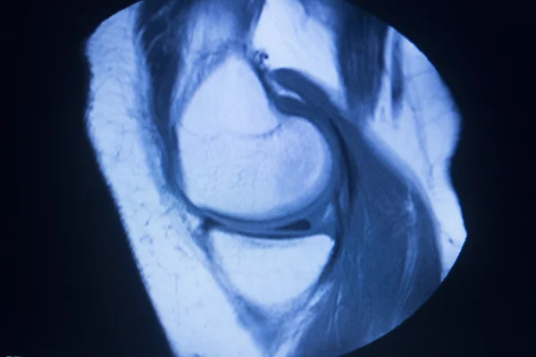 IRM imagerie par résonance magnétique balayage médical — Photo