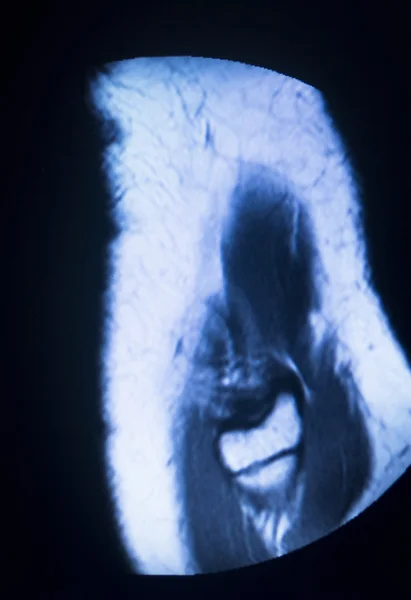 Mri Magnetresonanztomographie medizinischer Scan — Stockfoto