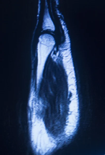 МРТ-магнитно-резонансная томография кисти запястья — стоковое фото