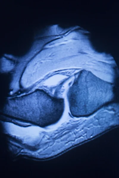 Mri 核磁気共鳴医学 — ストック写真