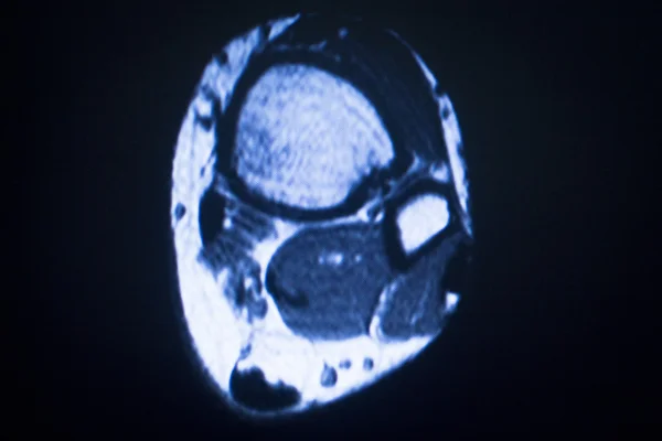 Ressonância magnética MRI varredura médica — Fotografia de Stock