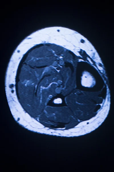 Ressonância magnética MRI varredura médica — Fotografia de Stock