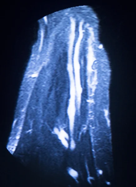 Mri 磁共振成像医学扫描 — 图库照片