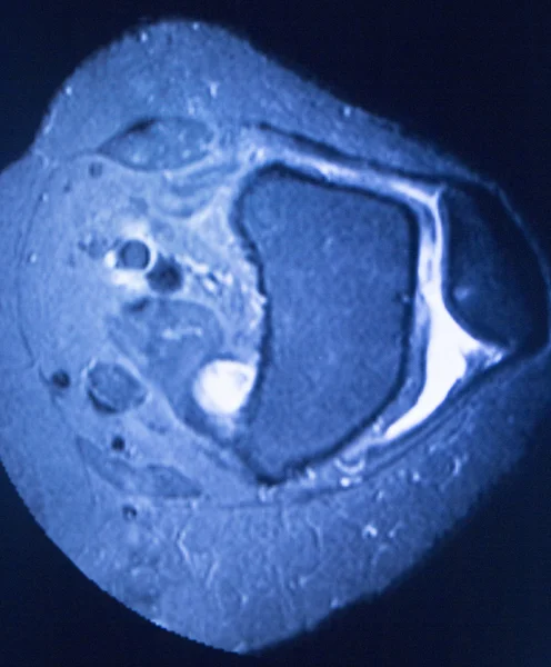 Skan medyczny rezonansu magnetycznego MRI — Zdjęcie stockowe