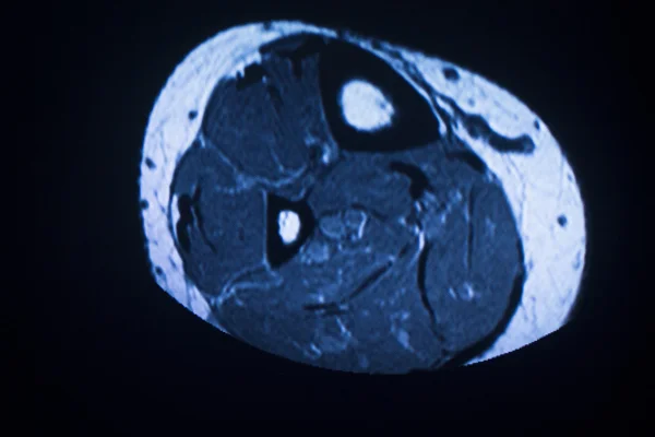 Mri Magnetresonanztomographie medizinischer Scan — Stockfoto