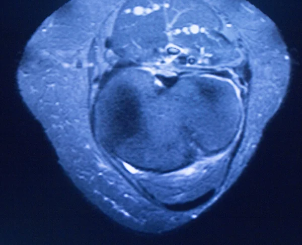 Mri 核磁気共鳴医学 — ストック写真