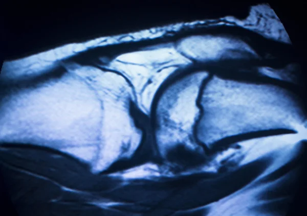 MRI magnetresonanstomografi medicinsk scan — Stockfoto