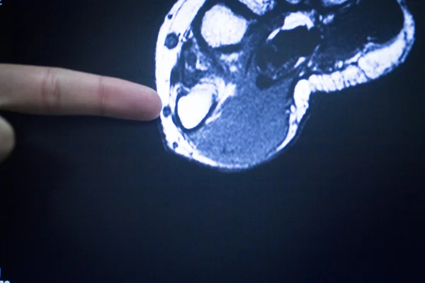 МРТ-магнитно-резонансная томография ног — стоковое фото