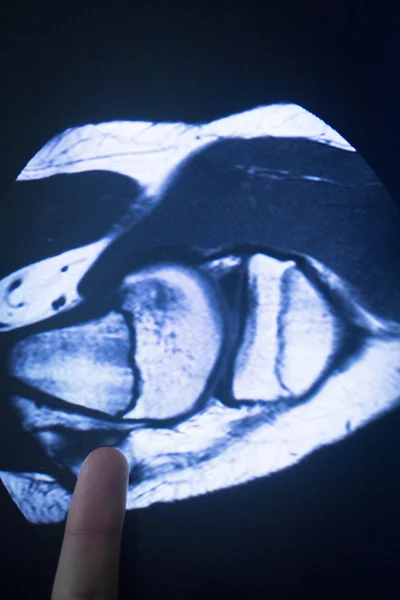 Skan medyczny rezonansu magnetycznego MRI — Zdjęcie stockowe