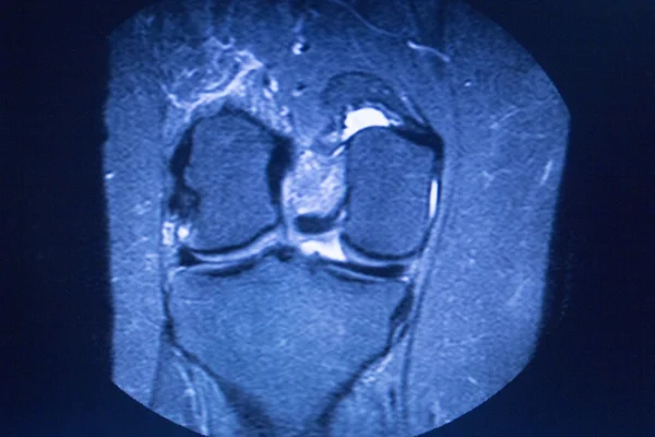 MRI magnetresonanstomografi medicinsk scan — Stockfoto