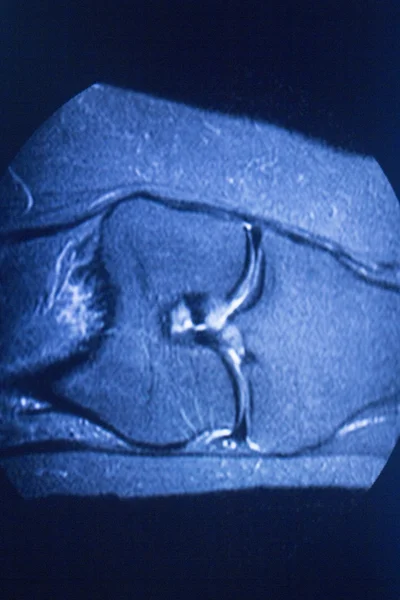 Mri 磁共振成像医学扫描 — 图库照片