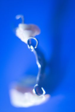 Çıkarılabilir Kısmi Protez