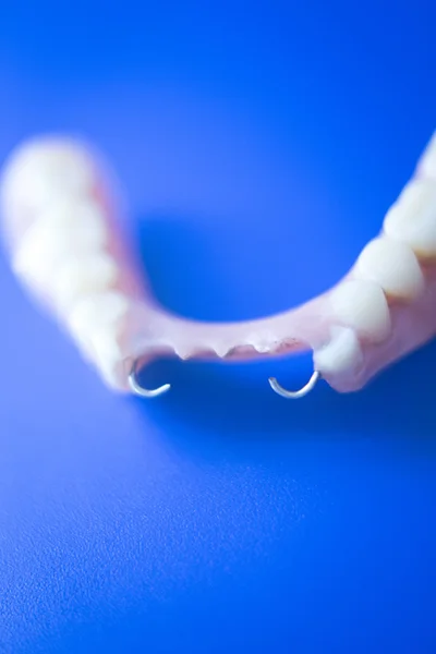 Removable partial dentures — Stock Photo, Image