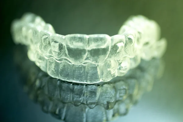 Aligners dentários suportes dentários aparelhos invisíveis — Fotografia de Stock