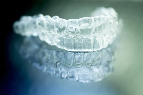 Aligners dentários suportes dentários aparelhos invisíveis — Fotografia de Stock
