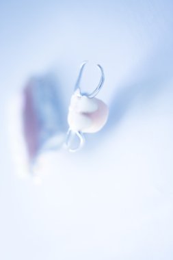 Çıkarılabilir Kısmi Protez