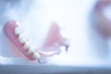 Removable partial dentures clipart