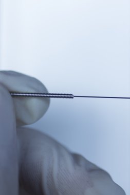 Akupunktur iğnesi kuru iğneleme yöntemlerinin etkinliğinin karşılaştırılması