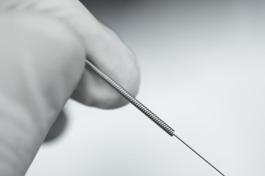 Akupunktur iğnesi kuru iğneleme yöntemlerinin etkinliğinin karşılaştırılması