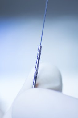 Akupunktur iğnesi kuru iğneleme yöntemlerinin etkinliğinin karşılaştırılması