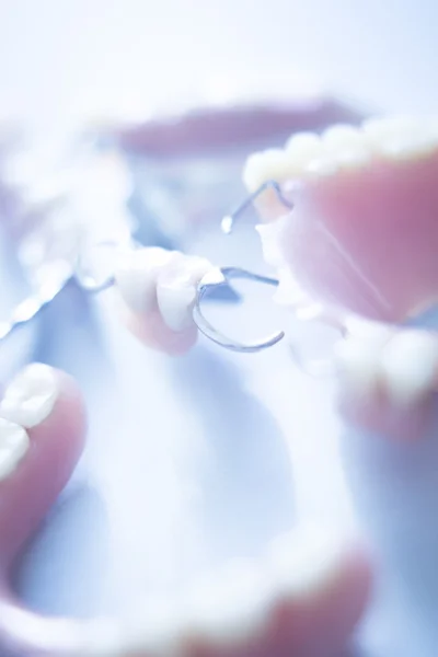 Dentiere parziali rimovibili — Foto Stock