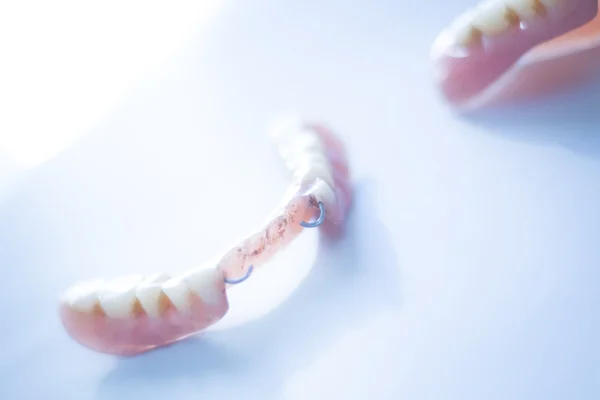 Removable partial dentures — Stock Photo, Image