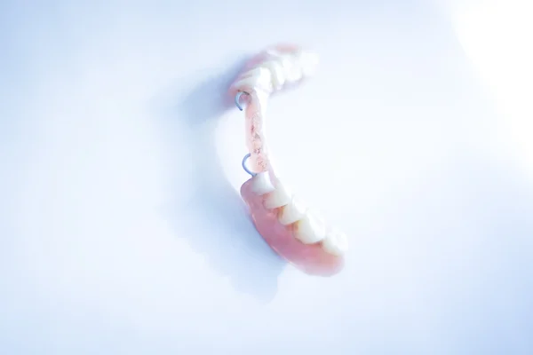 部分床義歯 — ストック写真
