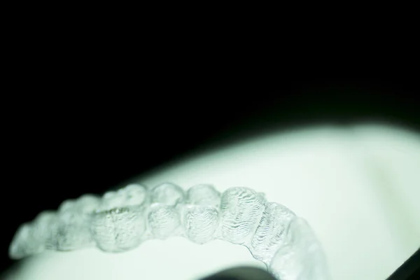 Οδοντιατρική ευθυγραμμιστές δοντιών αγκύλες αόρατα σιδεράκια — Φωτογραφία Αρχείου