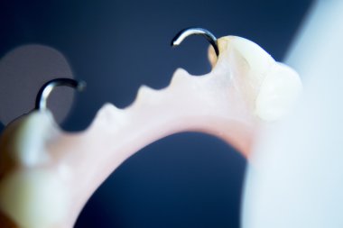 Protez diş Kısmi Protez