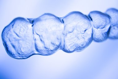 Diş hizmetli parantez görünmez diş telleri diş