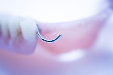 Protez diş Kısmi Protez