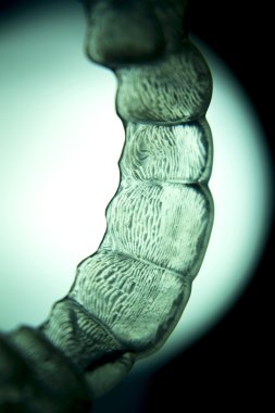 Diş hizmetli parantez görünmez diş telleri diş