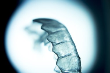 Diş hizmetli parantez görünmez diş telleri diş