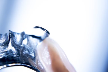 Protez diş Kısmi Protez