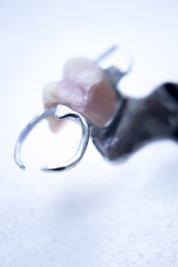 Protez diş Kısmi Protez