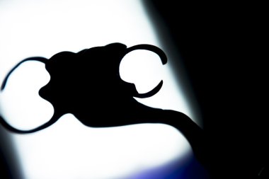 Protez diş Kısmi Protez