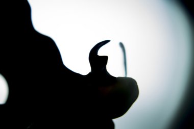 Protez diş Kısmi Protez