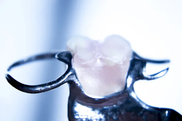 Prótese dentária prótese dentária parcial — Fotografia de Stock