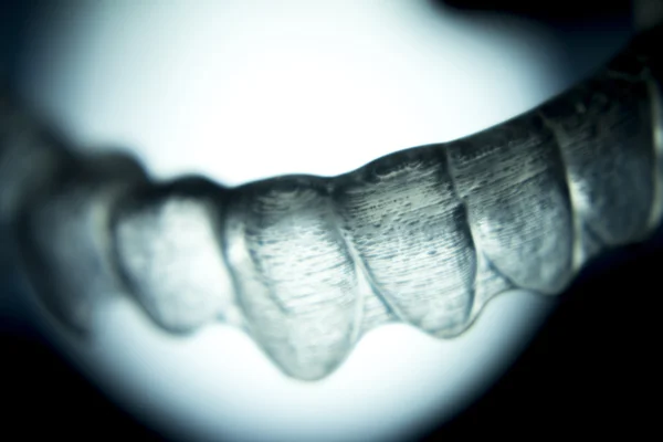 Retentores dentários suportes dentários aparelhos invisíveis — Fotografia de Stock