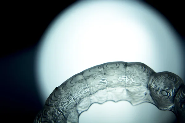 Стоматологические брекеты невидимые брекеты — стоковое фото