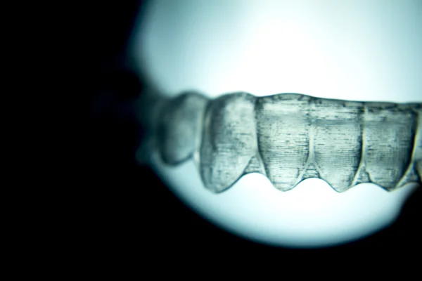 Zubní přívrženci zubní závorky neviditelná rovnátka — Stock fotografie