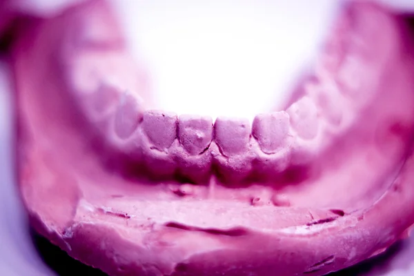 Prótesis dental molde dental de arcilla — Foto de Stock