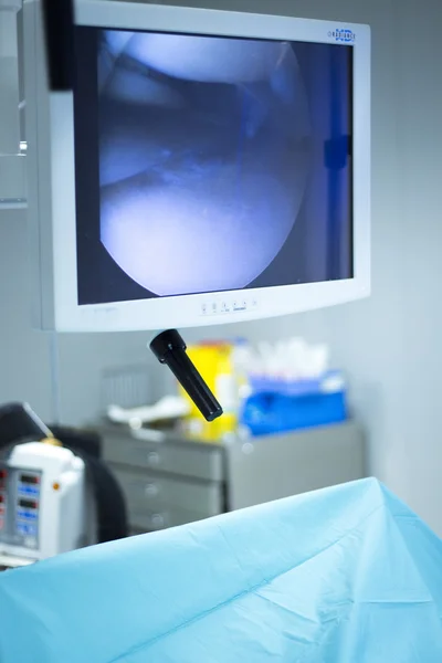 Hastane cerrahi Artroskopi işlemi ekran — Stok fotoğraf