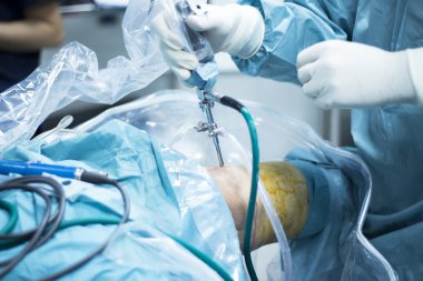 Diz artroskopisi ortopedik cerrahi operasyon