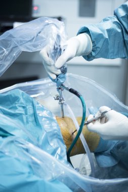 Diz artroskopisi ortopedik cerrahi operasyon