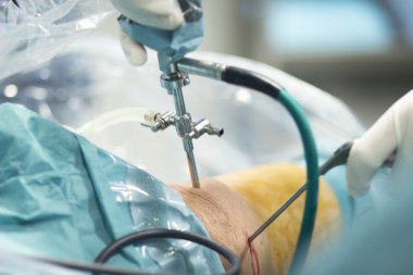 Ortopedik cerrahi Menisküs işlemi