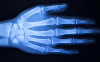 El parmak başparmak hastane xray inceden inceye gözden geçirmek