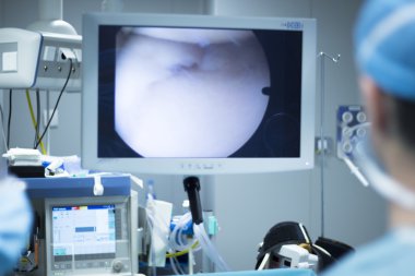 Hospital surgery arthroscopy operation screen clipart