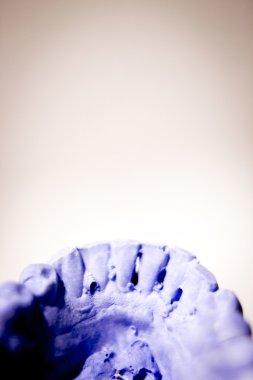 Diş Protez kil diş kalıp